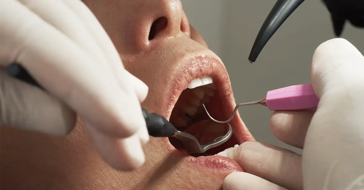 gum disease